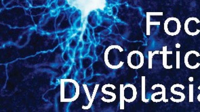 Focal Cortical Dysplasias, New advances for curing epilepsy, de Francine Chassoux et André Palmini